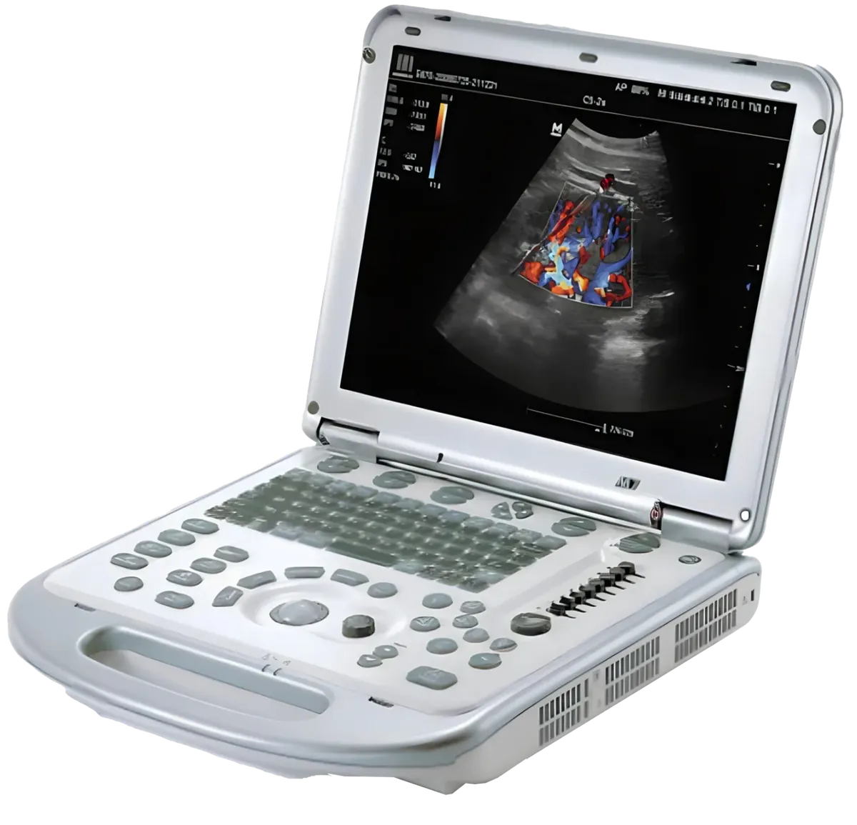 Mindray M7 Portable Ultrasound Machine