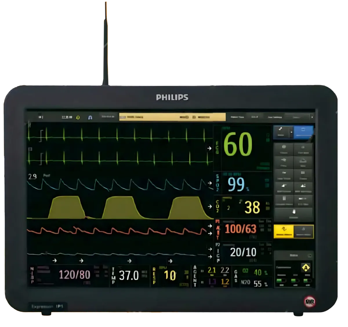 Philips Expression IP5 Monitor